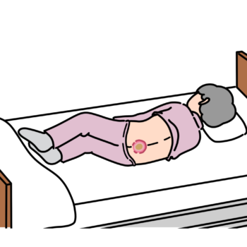 褥瘡とは？介護のための褥瘡の好発部位と予防方法マニュアル