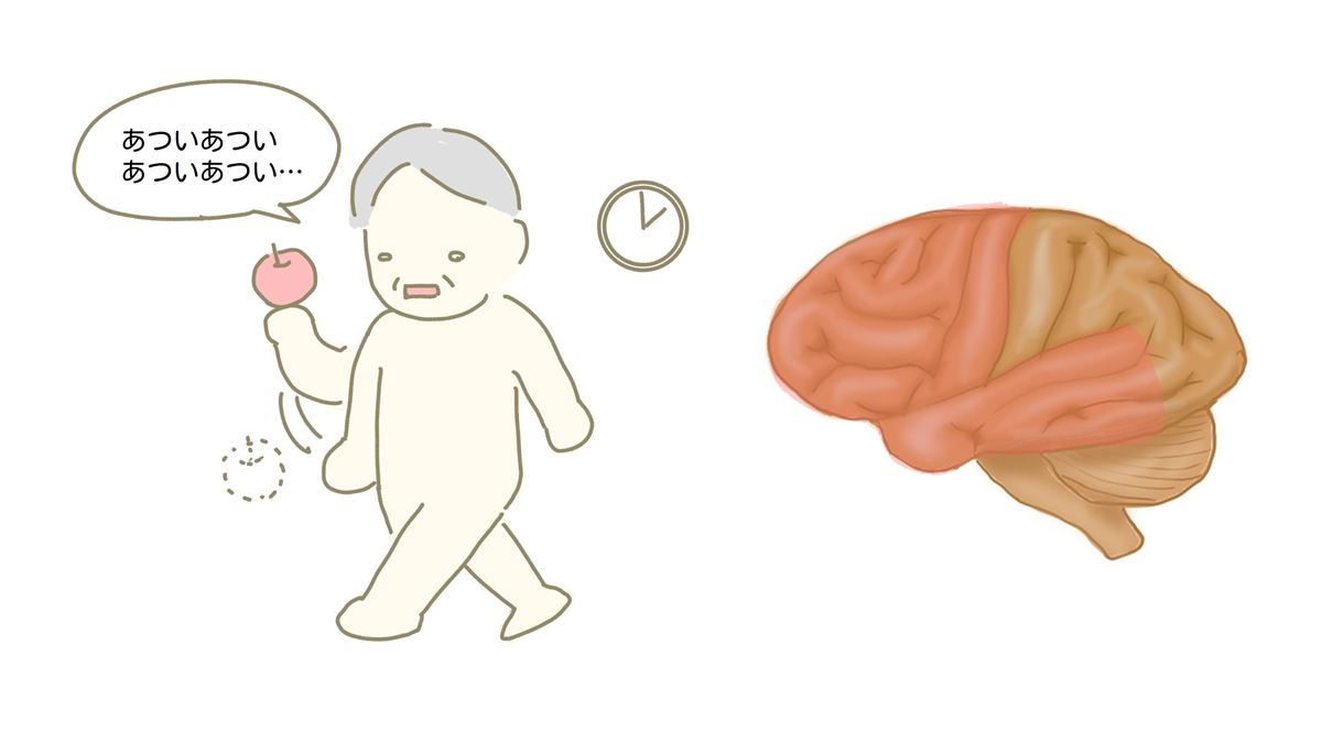 前頭側頭型認知症（ピック病）の特徴と介護対応｜症状・他の認知症との違いを解説